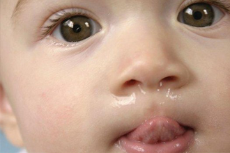 赤ちゃんの鼻水