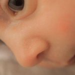 赤ちゃんの鼻血 原因と止め方